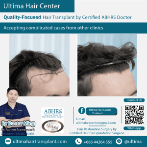 man hair transplant