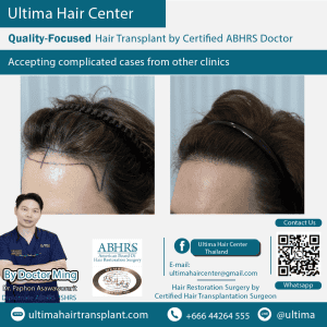 man hair transplant