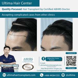 man hair transplant