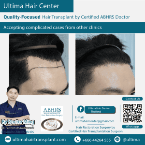 man hair transplant