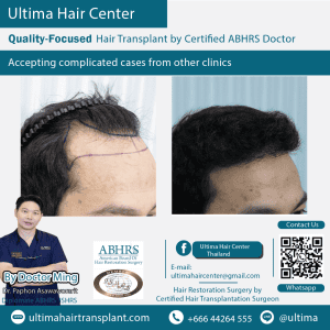 man hair transplant
