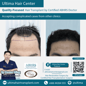 man hair transplant