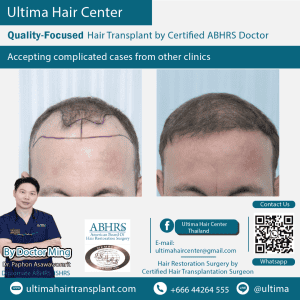 man hair transplant