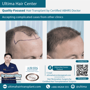 man hair transplant