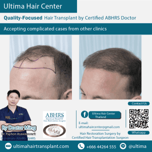 man hair transplant