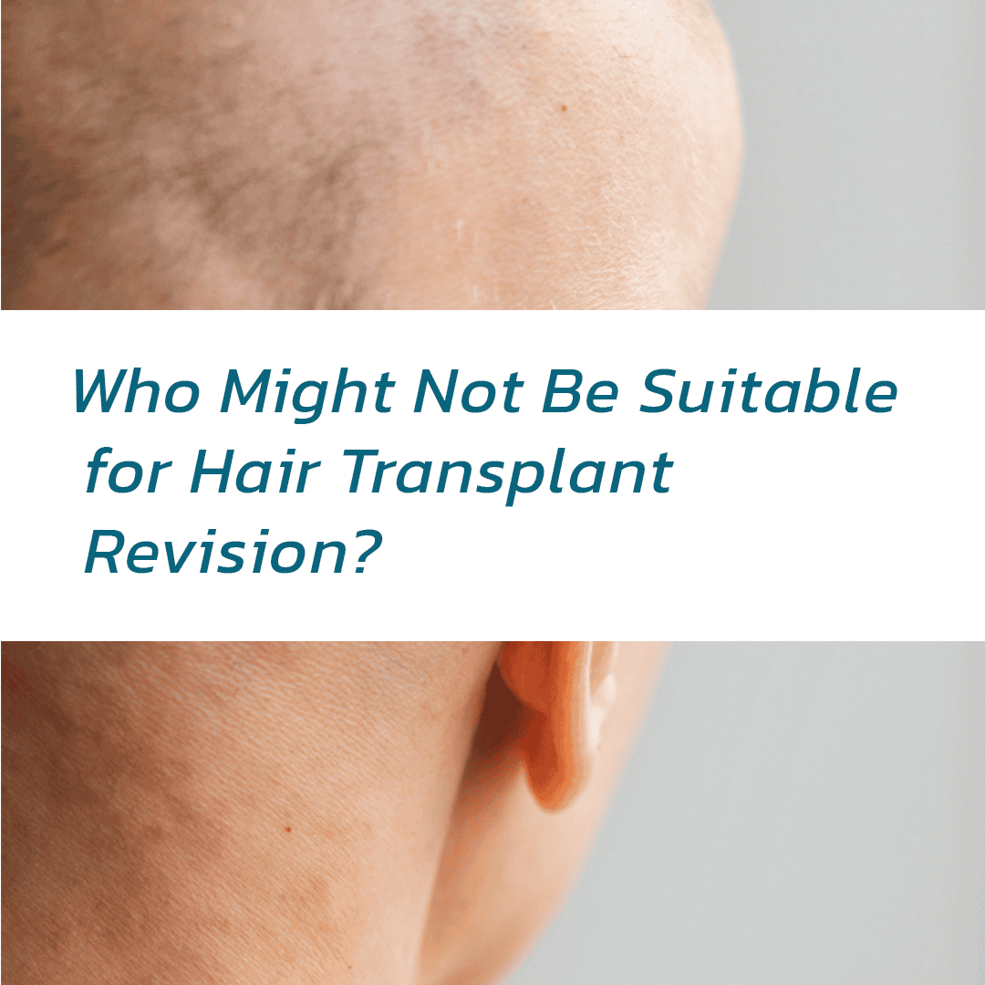 Hair transplant revision