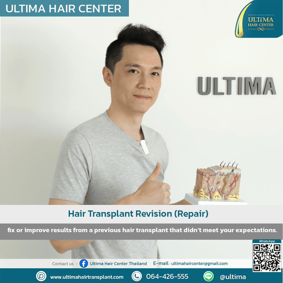Hair transplant revision