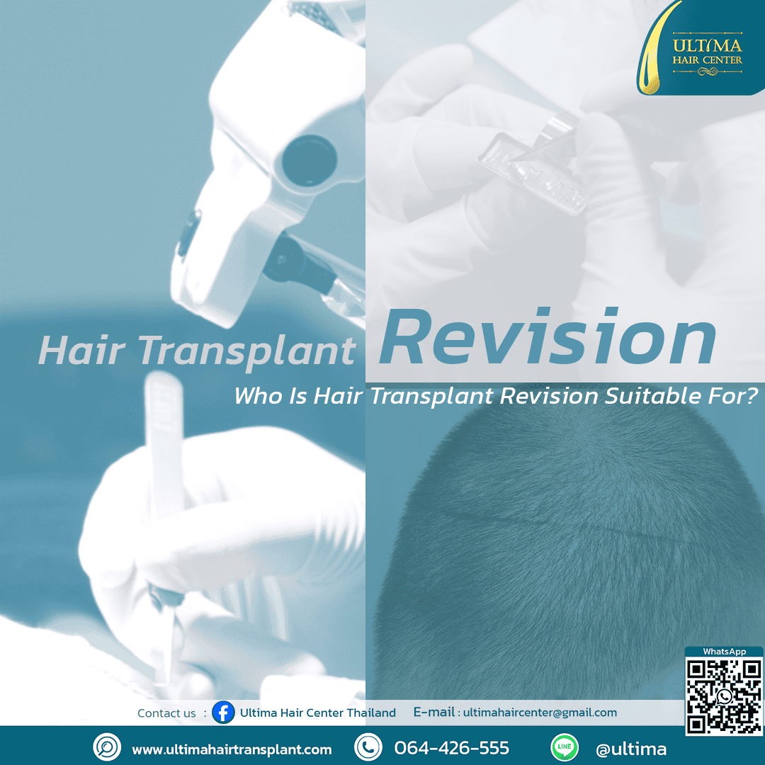 Hair transplant revision