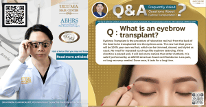 What is an Eyebrow Transplant