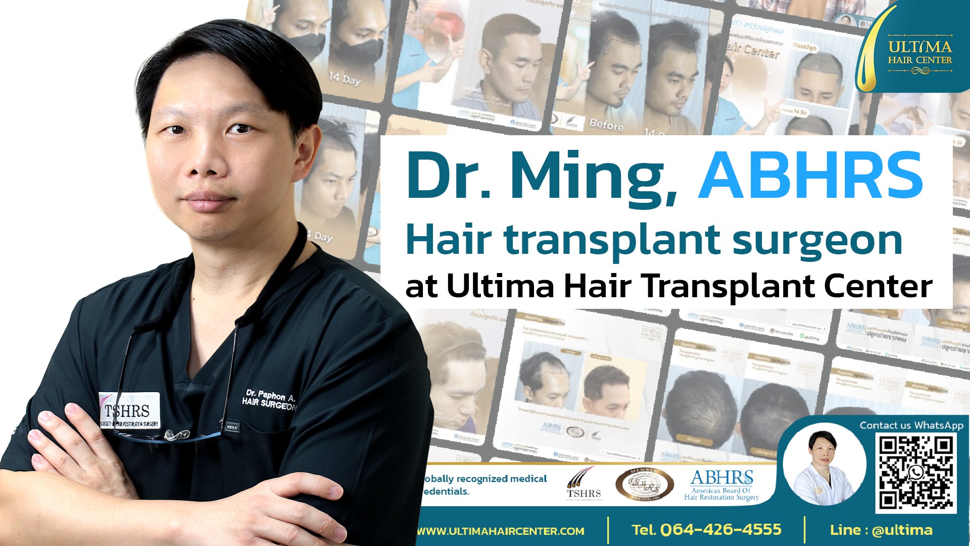 What Should You Do If You Want a Hair Transplant What Should You Do If You Want a Hair Transplant