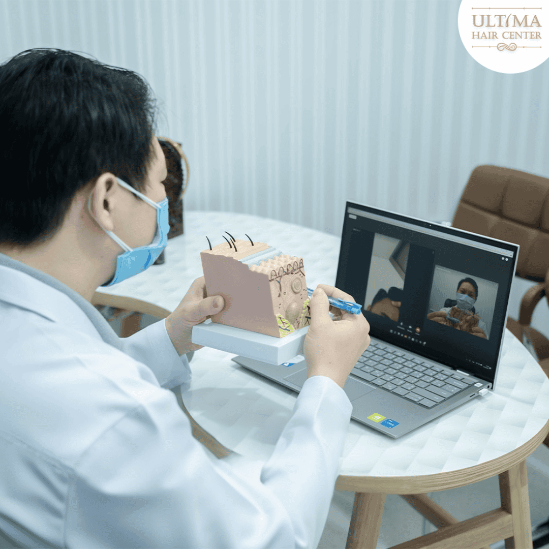 What Should You Do If You Want a Hair Transplant