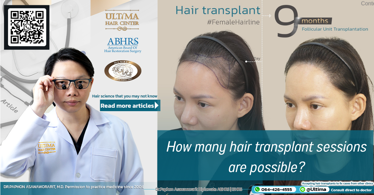 How many hair transplant sessions are possible How many hair transplant sessions are possible