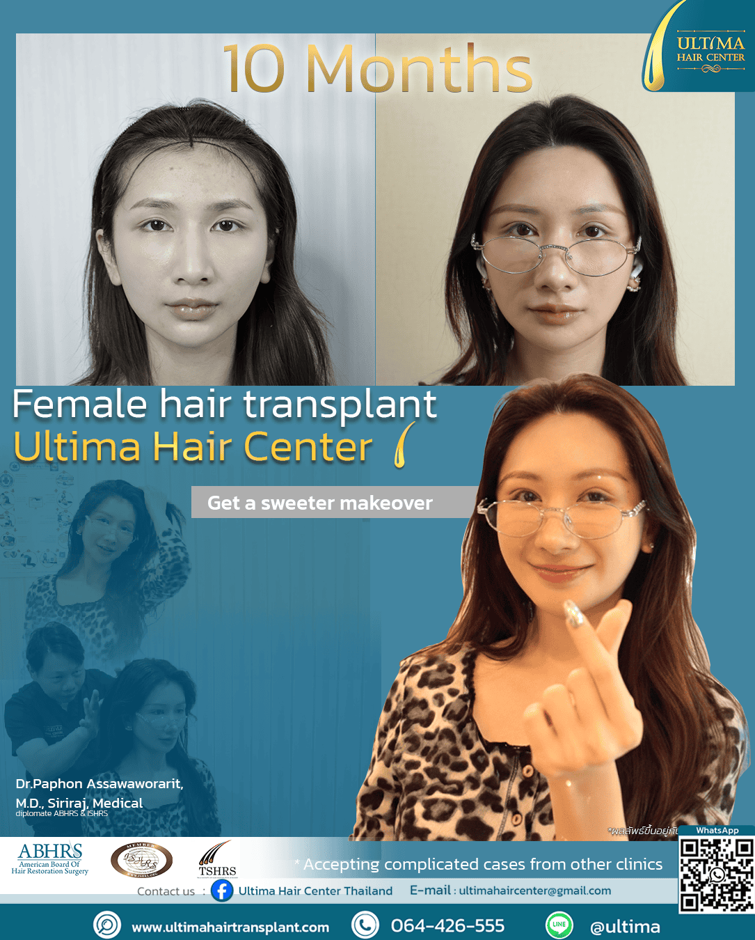 Do You Need Medication After a Hair Transplant