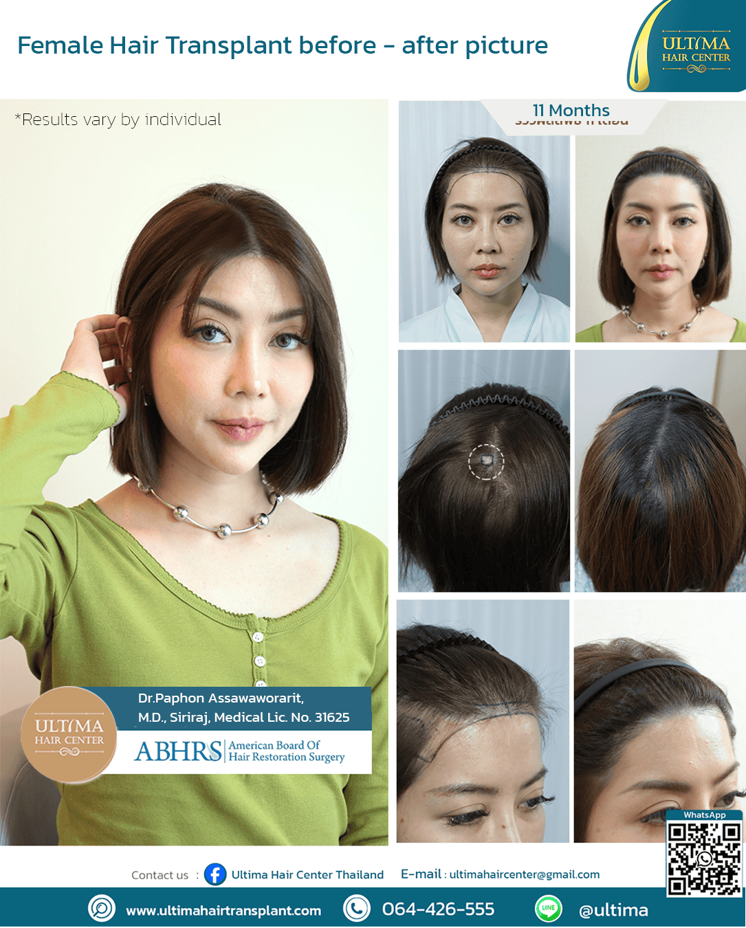 Do You Need Medication After a Hair Transplant