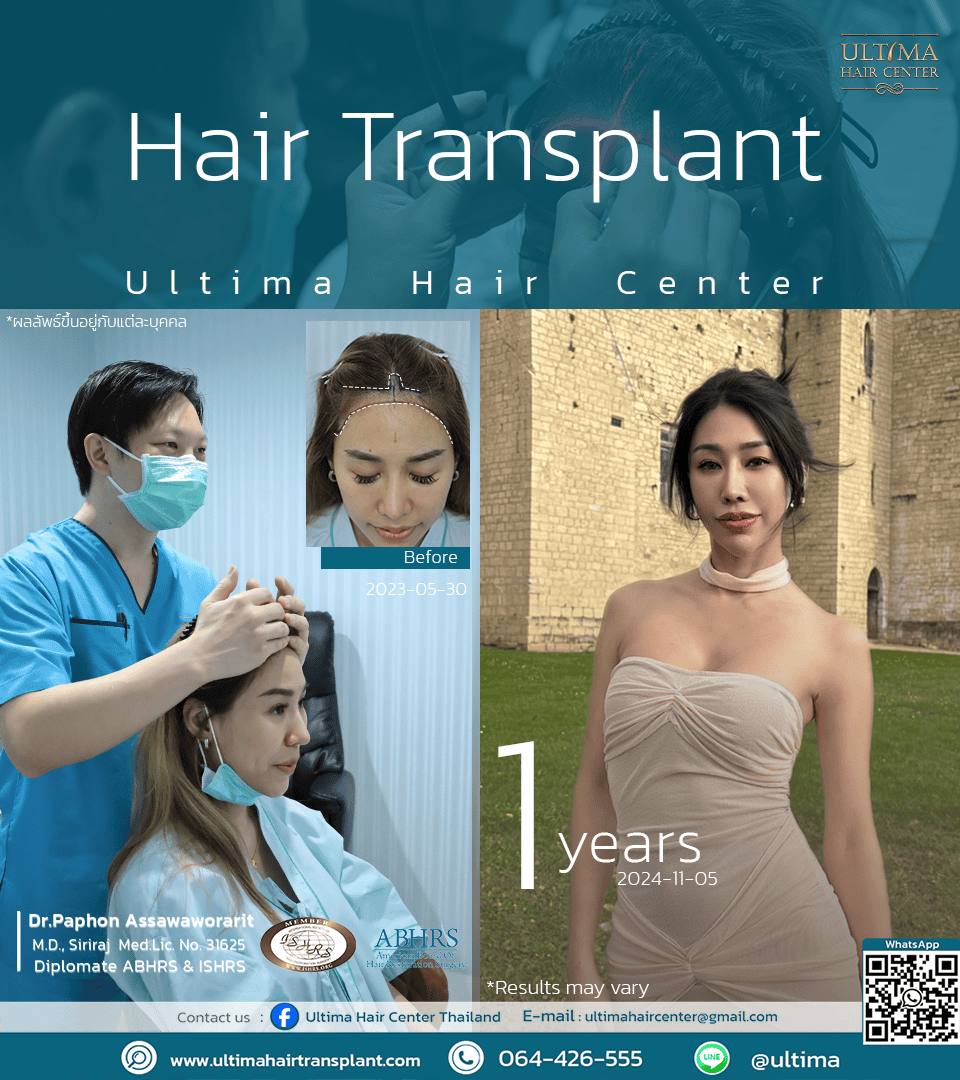 Do You Need Medication After a Hair Transplant
