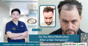 Do You Need Medication After a Hair Transplant