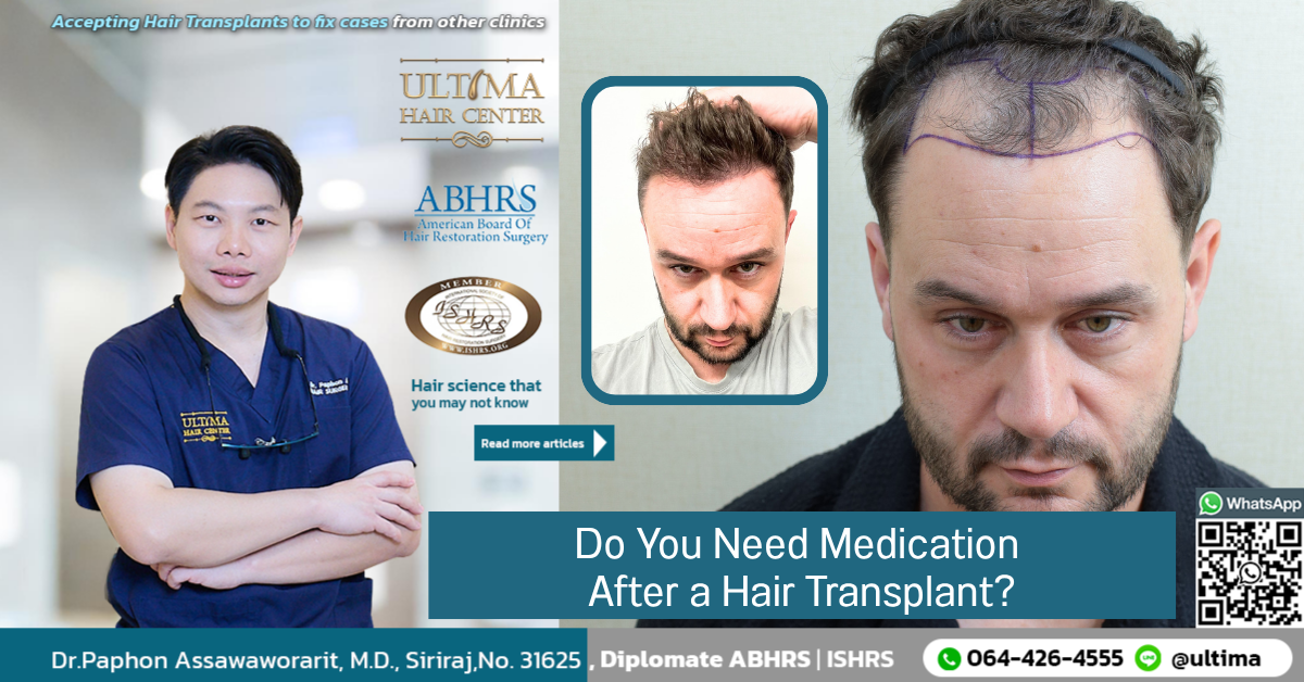 Do You Need Medication After a Hair Transplant Do You Need Medication After a Hair Transplant