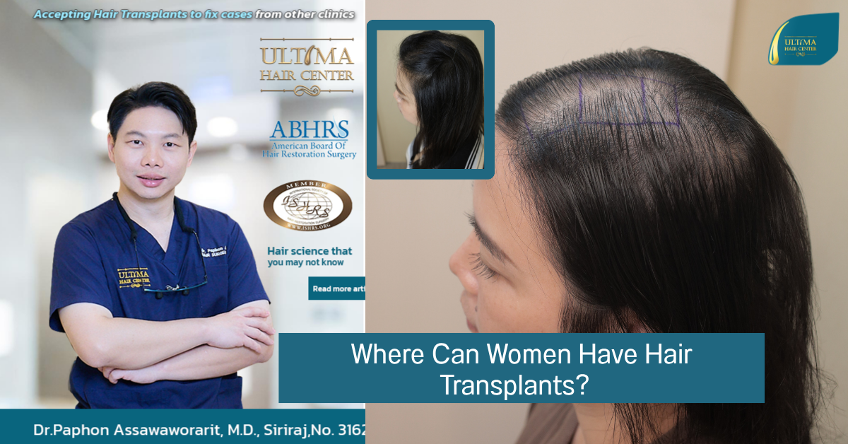 Where Can Women Have Hair Transplants